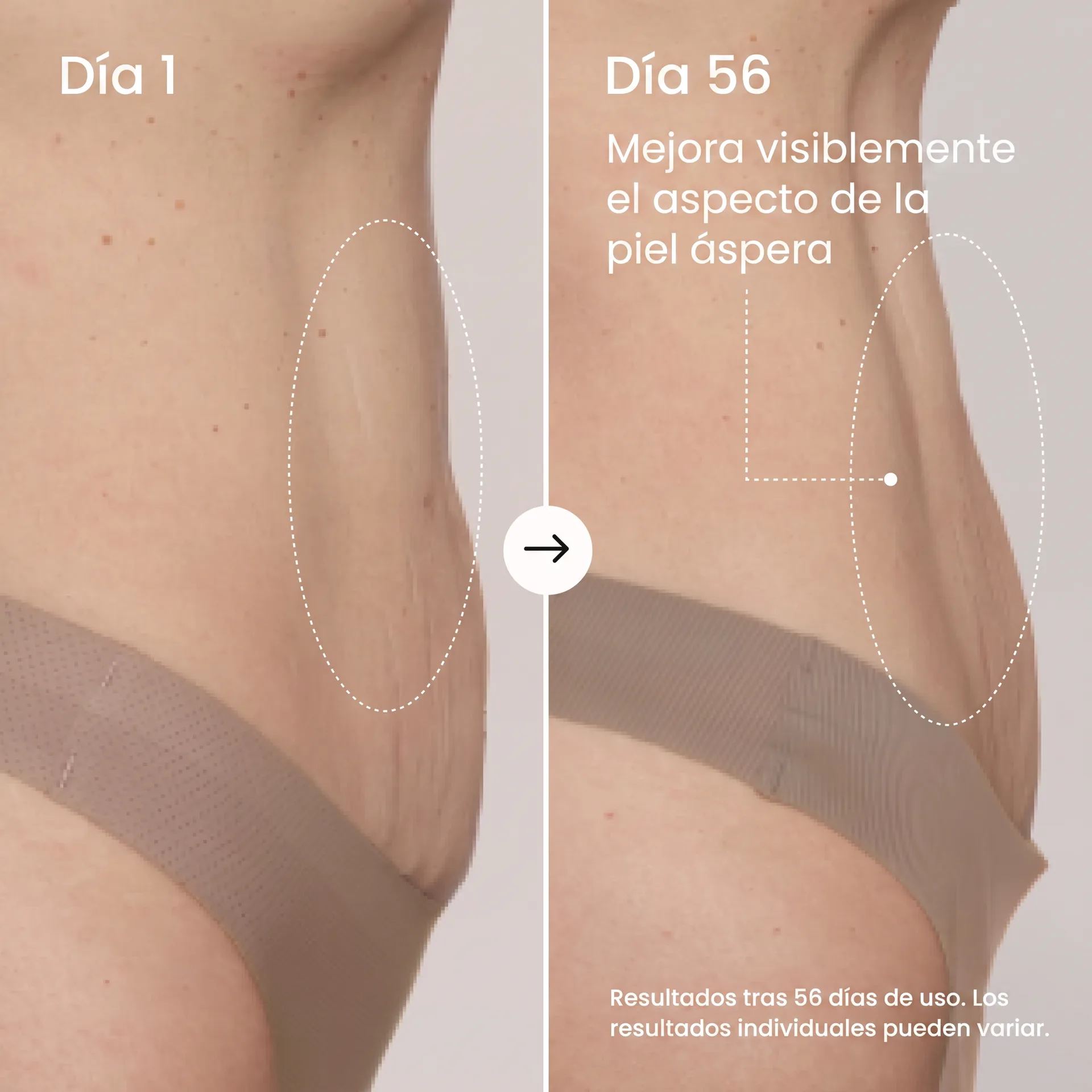 Comparativa lateral antes y después de 56 días de uso del producto de referencia