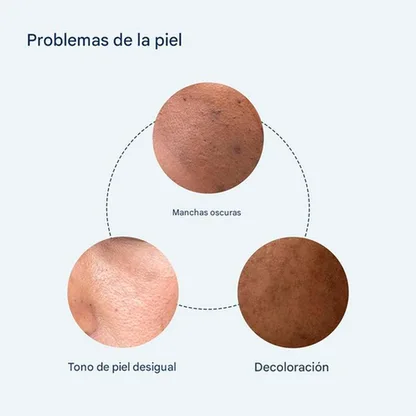 Sérum puntos negros