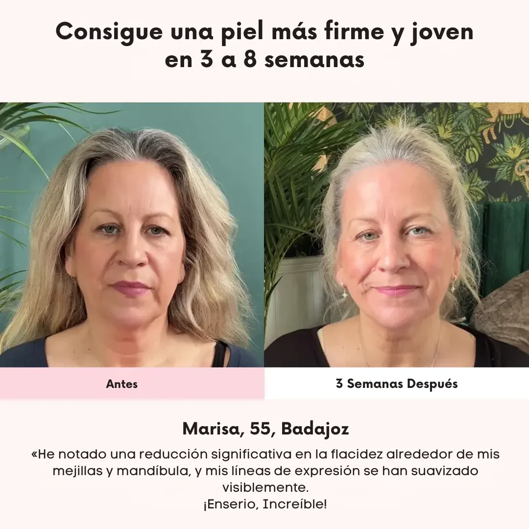 Máscara Facial Anti-Edad de 7 Colores LED y Microcorriente (EMS) para Lifting de Papada y Reafirmar Mejillas