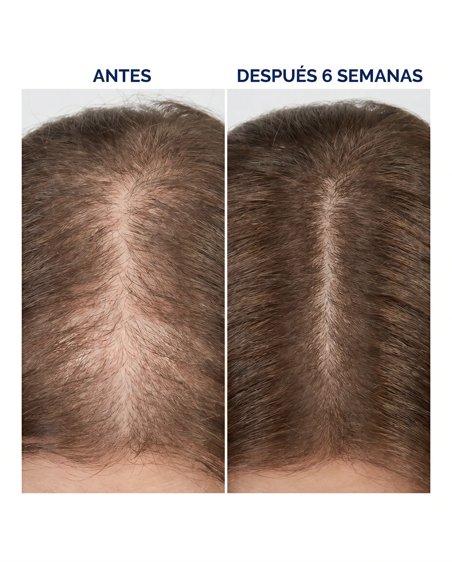 Sérum Capilar Densificador Roll-On