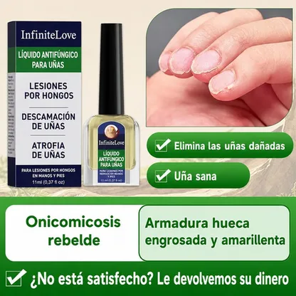 Líquido Antifúngico Uñas Tolnaftato 1% Tratamiento Hongos Manos y Pies 11ml