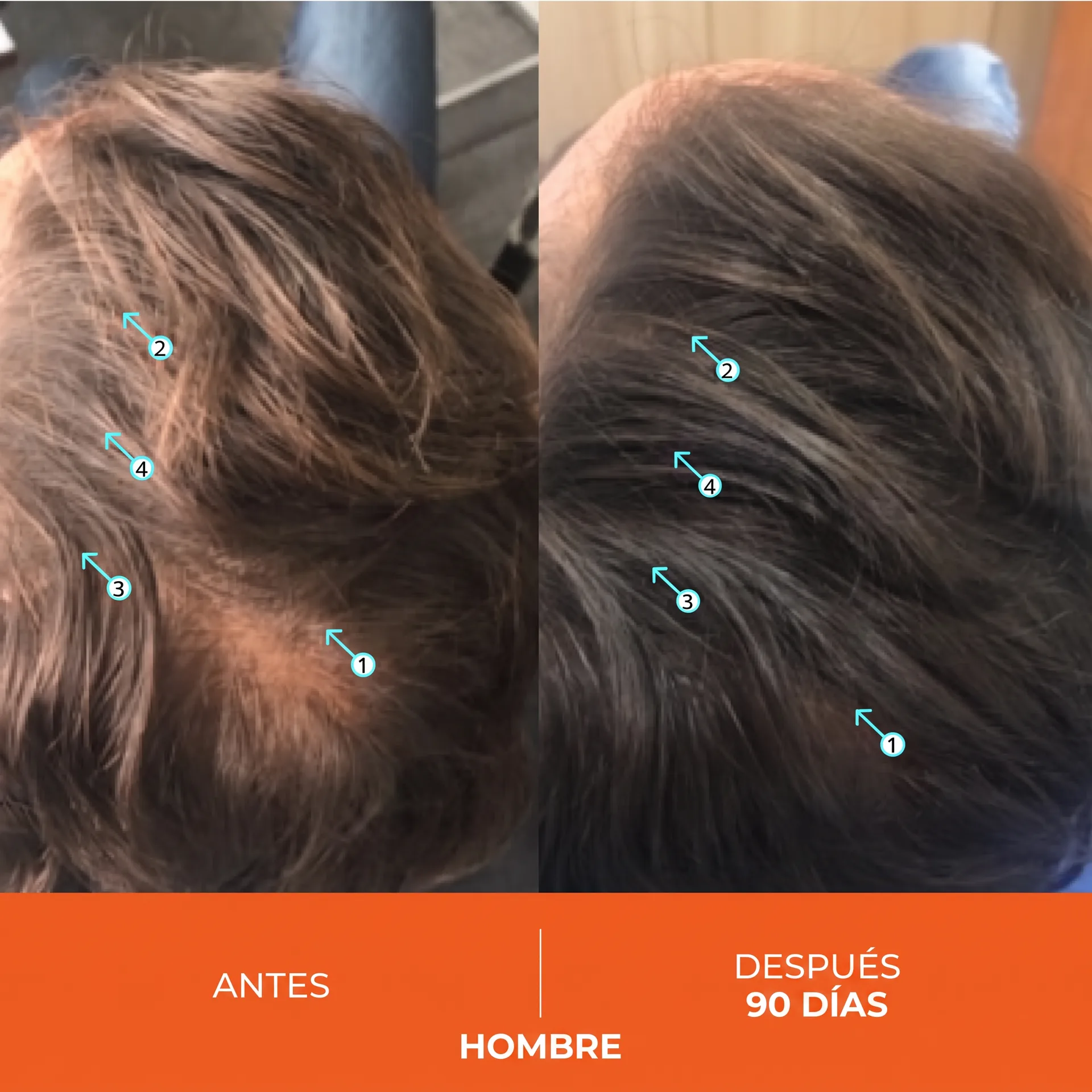 Antes y Después Hombre 90 Días