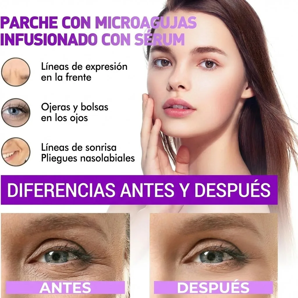 Parches de Microagujas 'MicroGlow' Infusionados con Retinol y Ácido Hialurónico para Rellenar Arrugas, Bolsas y Ojeras